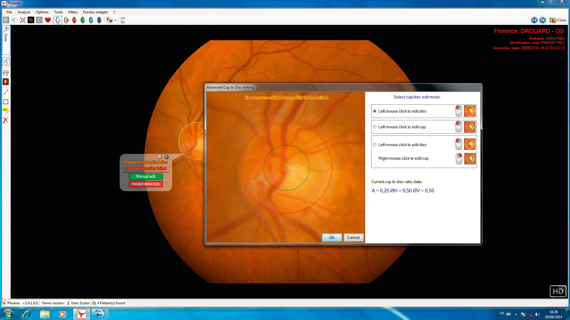 retina400_singlep_4_p3