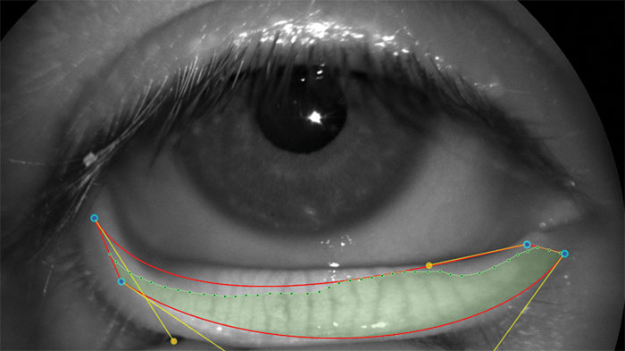 Topógrafo de córnea CORNEA 550 3 Topógrafo de córnea CORNEA 550